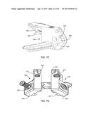 Interspinous Process Spacing Device diagram and image