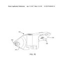 Interspinous Process Spacing Device diagram and image