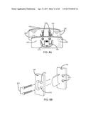 Interspinous Process Spacing Device diagram and image