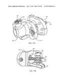 Interspinous Process Spacing Device diagram and image