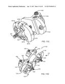 Interspinous Process Spacing Device diagram and image