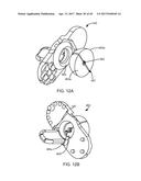 Interspinous Process Spacing Device diagram and image