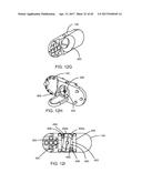 Interspinous Process Spacing Device diagram and image