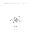 Interspinous Process Spacing Device diagram and image