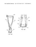 Interspinous Process Spacing Device diagram and image