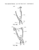 Interspinous Process Spacing Device diagram and image