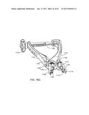 Interspinous Process Spacing Device diagram and image