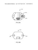 Interspinous Process Spacing Device diagram and image