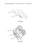 Interspinous Process Spacing Device diagram and image