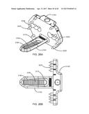 Interspinous Process Spacing Device diagram and image