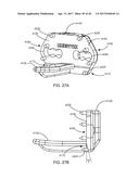 Interspinous Process Spacing Device diagram and image