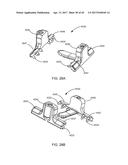 Interspinous Process Spacing Device diagram and image