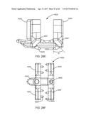 Interspinous Process Spacing Device diagram and image