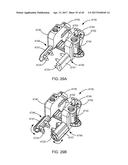 Interspinous Process Spacing Device diagram and image