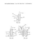 Interspinous Process Spacing Device diagram and image