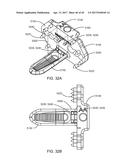 Interspinous Process Spacing Device diagram and image