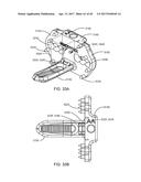 Interspinous Process Spacing Device diagram and image