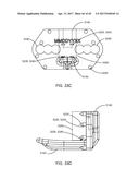 Interspinous Process Spacing Device diagram and image