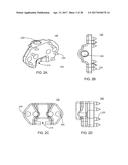 Interspinous Process Spacing Device diagram and image