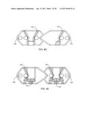 Interspinous Process Spacing Device diagram and image