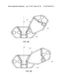 Interspinous Process Spacing Device diagram and image