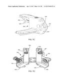 Interspinous Process Spacing Device diagram and image