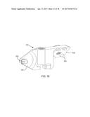 Interspinous Process Spacing Device diagram and image