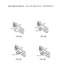 Interspinous Process Spacing Device diagram and image