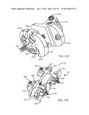 Interspinous Process Spacing Device diagram and image