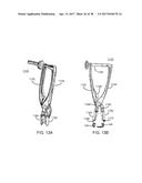 Interspinous Process Spacing Device diagram and image