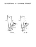 Interspinous Process Spacing Device diagram and image