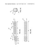 FUSION IMPLANT diagram and image