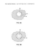 FUSION IMPLANT diagram and image