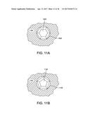 FUSION IMPLANT diagram and image