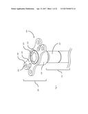 STRESS SHIELDING AND VARIABLE TENSIONING SYSTEM FOR PELVIC FRACTURE     MANAGEMENT OF OSTEOPOROTIC BONES diagram and image