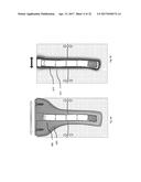 STRESS SHIELDING AND VARIABLE TENSIONING SYSTEM FOR PELVIC FRACTURE     MANAGEMENT OF OSTEOPOROTIC BONES diagram and image