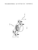 STRESS SHIELDING AND VARIABLE TENSIONING SYSTEM FOR PELVIC FRACTURE     MANAGEMENT OF OSTEOPOROTIC BONES diagram and image