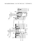 STRESS SHIELDING AND VARIABLE TENSIONING SYSTEM FOR PELVIC FRACTURE     MANAGEMENT OF OSTEOPOROTIC BONES diagram and image