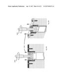 STRESS SHIELDING AND VARIABLE TENSIONING SYSTEM FOR PELVIC FRACTURE     MANAGEMENT OF OSTEOPOROTIC BONES diagram and image