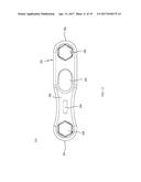 MOVEABLE BONE PLATE IMPLANTATION SYSTEM AND METHOD OF USE diagram and image