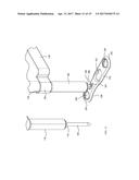 MOVEABLE BONE PLATE IMPLANTATION SYSTEM AND METHOD OF USE diagram and image