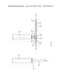 MOVEABLE BONE PLATE IMPLANTATION SYSTEM AND METHOD OF USE diagram and image