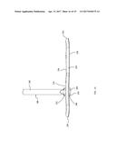 MOVEABLE BONE PLATE IMPLANTATION SYSTEM AND METHOD OF USE diagram and image