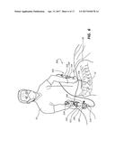 DEVICES FOR PERFORMING A MEDICAL PROCEDURE WITHIN AN APPROPRIATE INTERVAL     AND RELATED SYSTEMS AND METHODS diagram and image