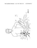 DEVICES FOR PERFORMING A MEDICAL PROCEDURE WITHIN AN APPROPRIATE INTERVAL     AND RELATED SYSTEMS AND METHODS diagram and image