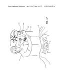 DEVICES FOR PERFORMING A MEDICAL PROCEDURE WITHIN AN APPROPRIATE INTERVAL     AND RELATED SYSTEMS AND METHODS diagram and image