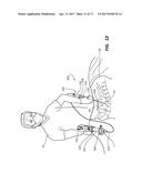 DEVICES FOR PERFORMING A MEDICAL PROCEDURE WITHIN AN APPROPRIATE INTERVAL     AND RELATED SYSTEMS AND METHODS diagram and image