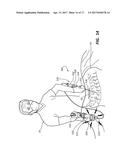 DEVICES FOR PERFORMING A MEDICAL PROCEDURE WITHIN AN APPROPRIATE INTERVAL     AND RELATED SYSTEMS AND METHODS diagram and image