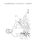 DEVICES FOR PERFORMING A MEDICAL PROCEDURE WITHIN AN APPROPRIATE INTERVAL     AND RELATED SYSTEMS AND METHODS diagram and image