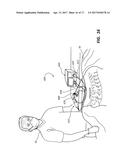 DEVICES FOR PERFORMING A MEDICAL PROCEDURE WITHIN AN APPROPRIATE INTERVAL     AND RELATED SYSTEMS AND METHODS diagram and image